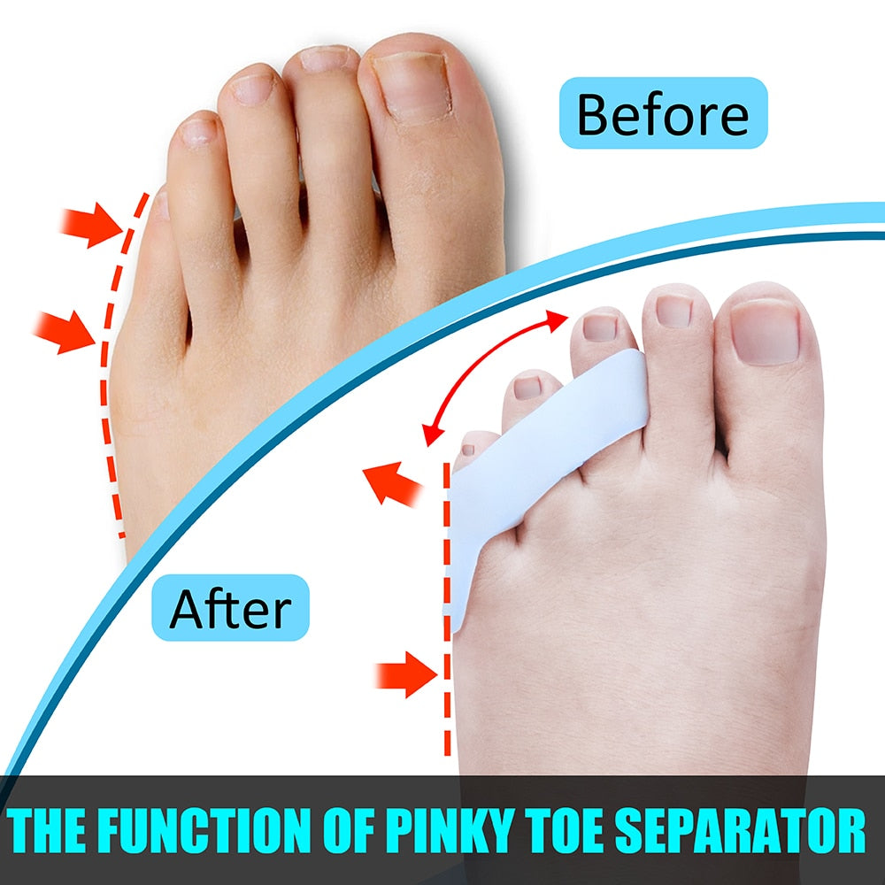 Pinky Toe Separators - Tailor's Bunion (4pcs, 2 pairs)